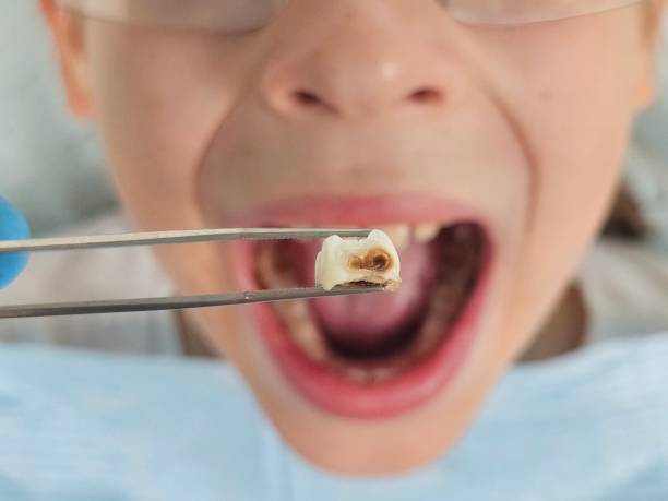Best Emergency Dentist for Special Needs Patients in Shawnee Hills, OH